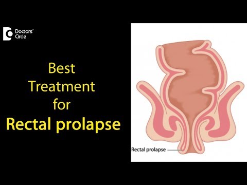 What is a Rectal prolapse? How is it treated? - Dr. Rajasekhar M R