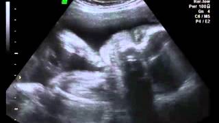 DVD VIDEO RECORDER Title 01 01