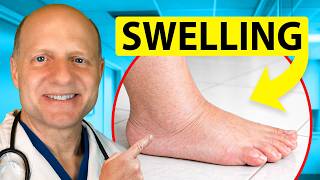 Your Ankle Swelling Might Not Be What You Think β Doctor Explains