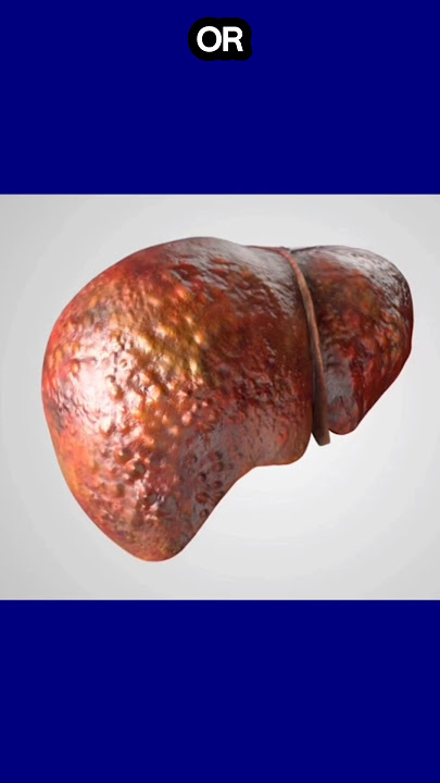 Liver Damage #short #hepaticdisease #healthtips #liverdamage