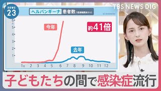 「ヘルパンギーナ」過去10年間で最多 「RSウイルス」も流行で小児科病床がひっ迫も【news23】｜TBS NEWS DIG