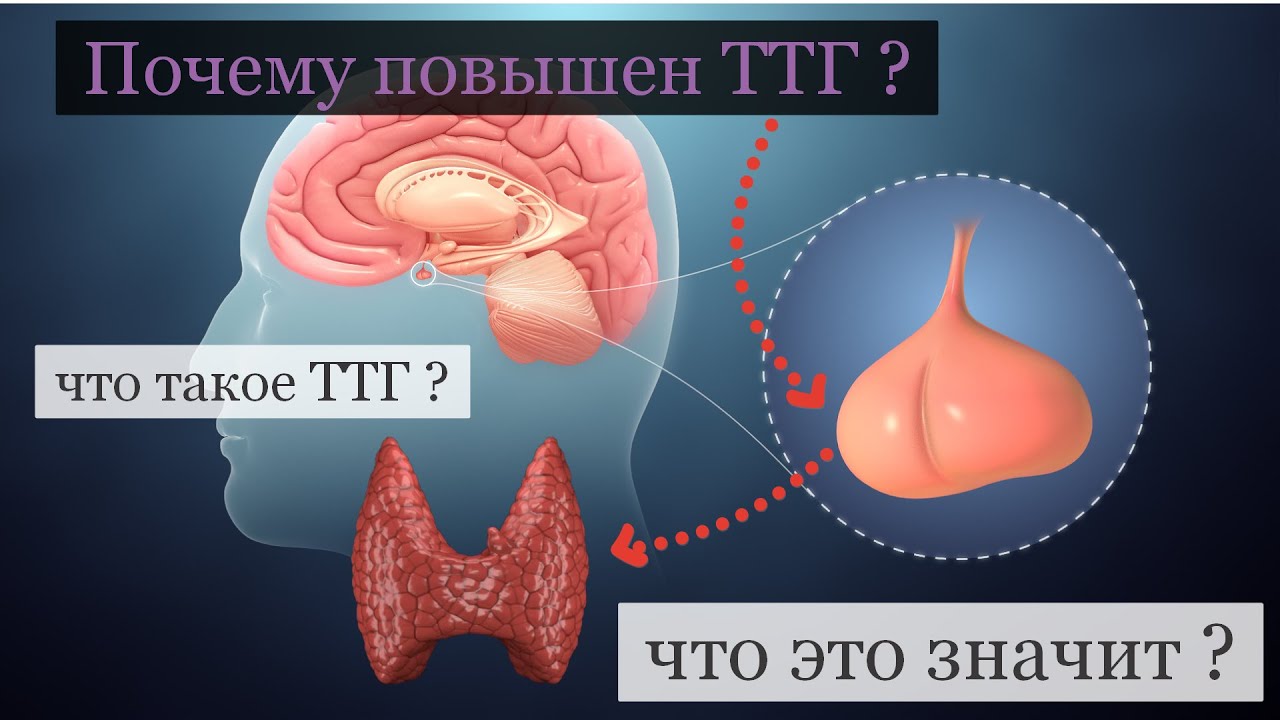 почему повышен ТТГ и что это значит ? - YouTube