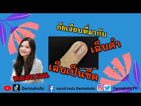 วีดีโอ: ทำไมเล็บเท้าถึงเปลี่ยนเป็นสีดำ?