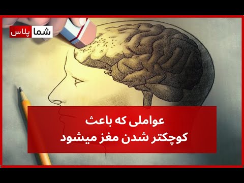 عواملی که باعث کوچک شدن مغز میشود