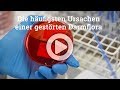 Die häufigsten Ursachen einer gestörten Darmflora - Dysbiose