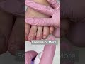 This Toenail Makeover Is So Satisfying 🤍