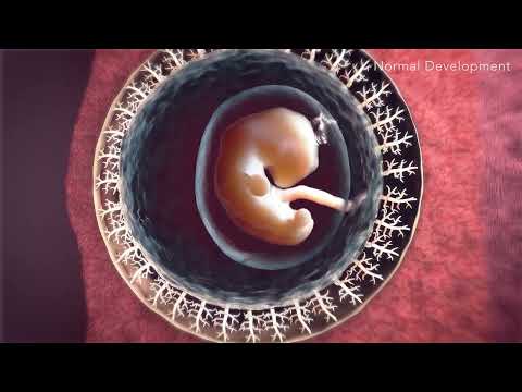 Video: Unde se atașează placenta?