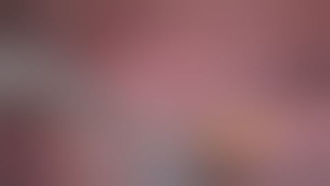 Robotic Right Middle Lobe Lobectomy