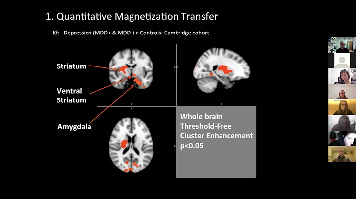 Neuropsychiatry: The Interface Between Immunology ...