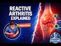 Reactive Arthritis Explained – When Your Immune System Attacks After Infection