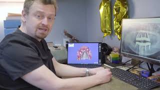 Dr. Ben Hanson explains the process of Implant Surgery
