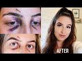 HOW TO COVER A BLACK EYE WITH MAKEUP
