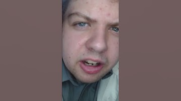 Fastest Cranial Nerve Exam But You Failed | ASMR