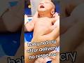 baby not cry after dilevery no response baby 😭😱😰#newbornbaby #youtubeshorts #viralvideo #baby