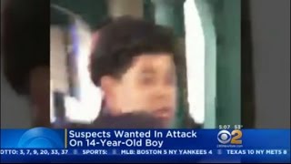 Suspects Wanted In Attack On 14-Year-Old Boy