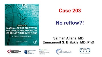 Case 203: Manual of CTO PCI - No reflow?!