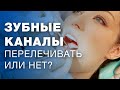 Лечение каналов зубов / пломбирование зубных каналов / пломбирование корневых каналов