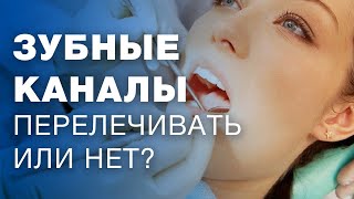 Лечение каналов зубов / пломбирование зубных каналов / пломбирование корневых каналов