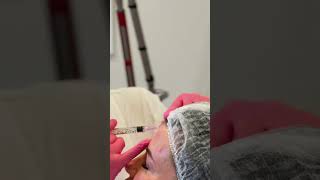 Биоревитализация JaluPro — молодость без операций! #MelsytechClinics #КосметологМосква