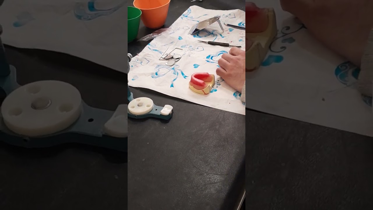 تركيب المثال الجبسي على المطبق  _Installing the gypsum model  on the articular  2