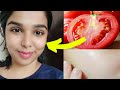 Get Glossy Glass Skin | Tomato skin brightening instant Facial | Glowing Skin in Tamil