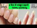 Grow nails In just 3 days || ३ दिन में नाख़ून बढ़ाये || नाखून को बढ़ाने के 100% working उपाय