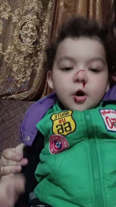 fiter rocked baby shocked