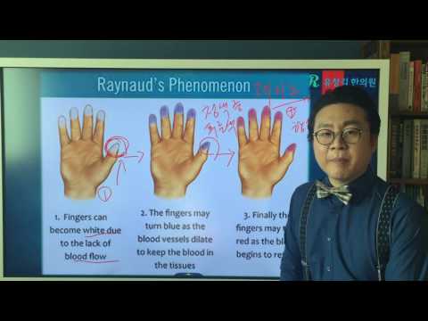 레이노 현상(Raynaud&rsquo;s Phenomenon)에 대해서