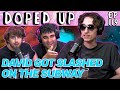 David slash david klash on doped up ep119