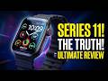 Apple Watch Series 11 Worth It? Full Review &amp; New Features