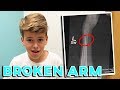 11 YEAR OLD BREAKS ARM AT FRIEND'S HOUSE | FIRST BROKEN ARM | FIRST BROKEN BONE | TERRIBLE TIMING