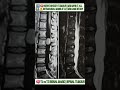 #Mri #radiology #spinemri #medical #doctor #shorts #viral #trending  #diagnosis #trending #viral
