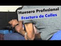 Huesero Profesional ~ Fractura de colles ~ Fractura de muñeca.