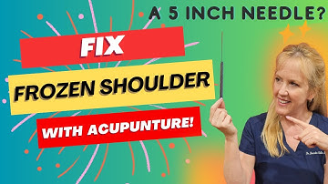 FIX Frozen Shoulder with Acupuncture