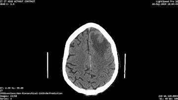 GE Lightspeed Pro 16 CT Scanner