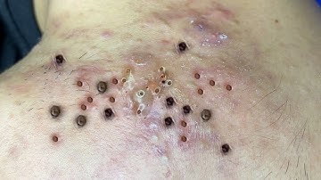 Enjoy Every Day With The Best Video Loan Nguyen Spa Official  1502