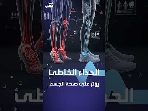 الحذاء الخاطئ يؤثر على صحة الجسم