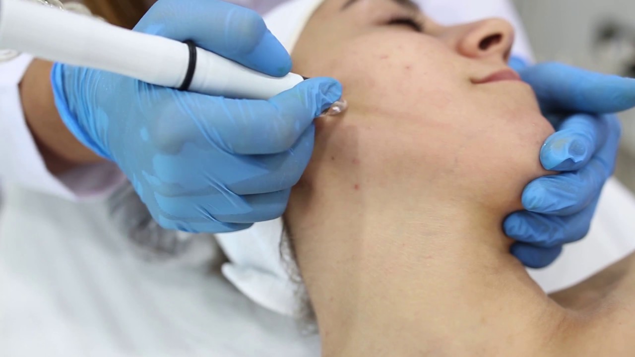 Hdyrafacial cilt bakımı!