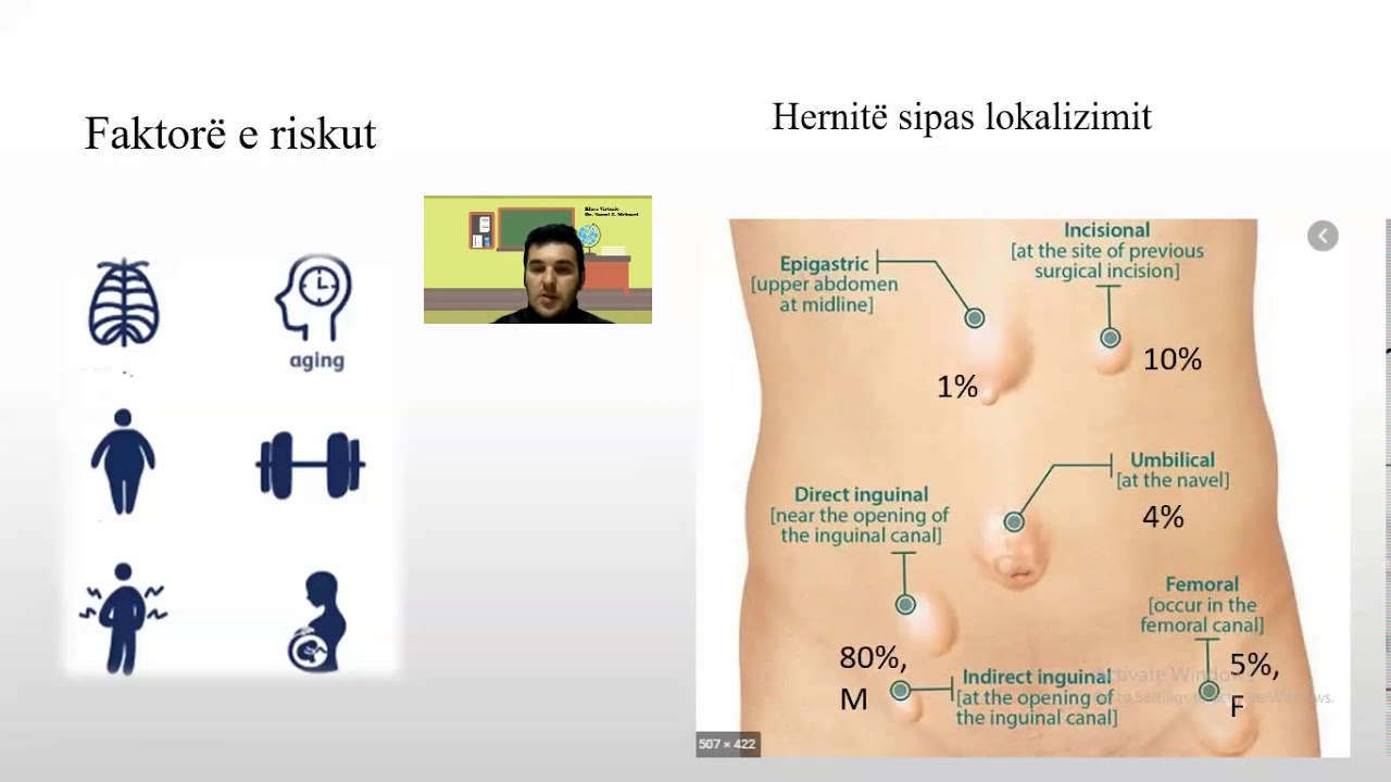 #SHM4 - Kirurgji me kujdes - Herniet (bruhi)