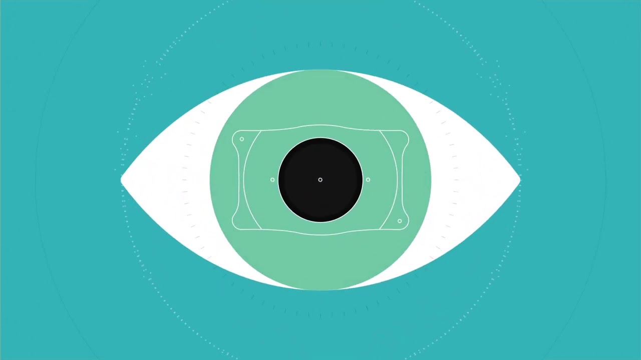 What are Implantable Contact Lenses ICLs Discover EVO Vision ICLs