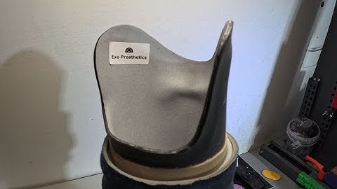 3D printed prosthetic socket insert design and fitting. Swift Prosthetics