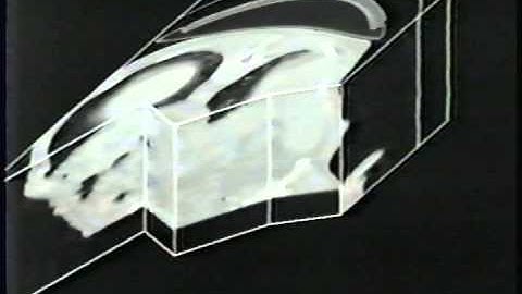 1984 Ikonas/Adage 3000 Programmable Graphics Processor - Medical Imaging demo