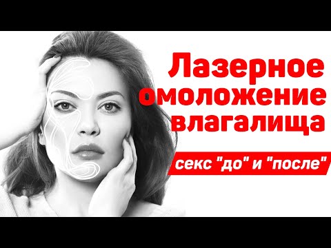 Интимное омоложение. Лазерное омоложение влагалища. Секс "до" и "после" процедуры.