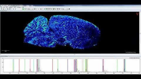 10-10 Imaging Mass Spectrometry Link2