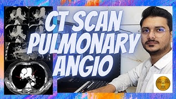 CT SCAN || Pulmonary angio filming process #angiography #pulmonary #radiologytechnologist