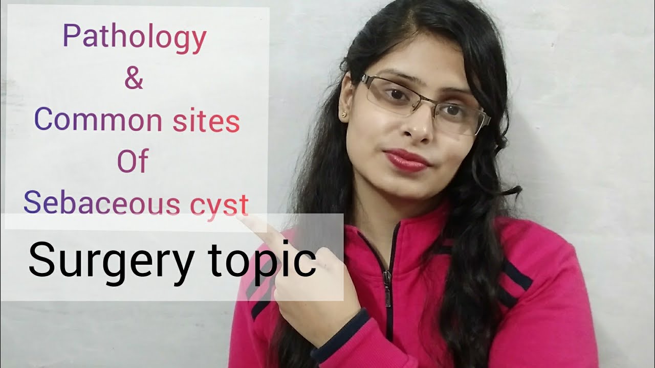 Pathology and common sites of sebaceous cyst in hindi / learn with fun