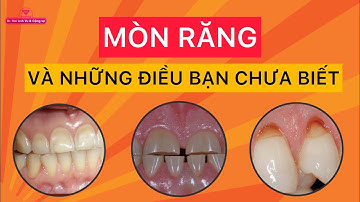 Mòn răng , những điều bạn cần biết | Tt Niềng Răng quốc tế Diamond