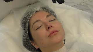 видео: Экспресс-протокол для сухой кожи: Результат за 1 процедуру! ⚡️🍂 картинка: Экспресс-протокол для сухой кожи: Результат за 1 процедуру! ⚡️🍂