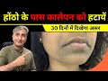 HOW TO REMOVE DARKNESS AROUND MOUTH I HOW TO GET FAIR SKIN I DR. MANOJ DAS #drmanojdas