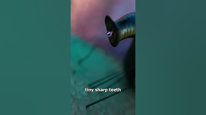 How Leeches Suck Your Blood 😟